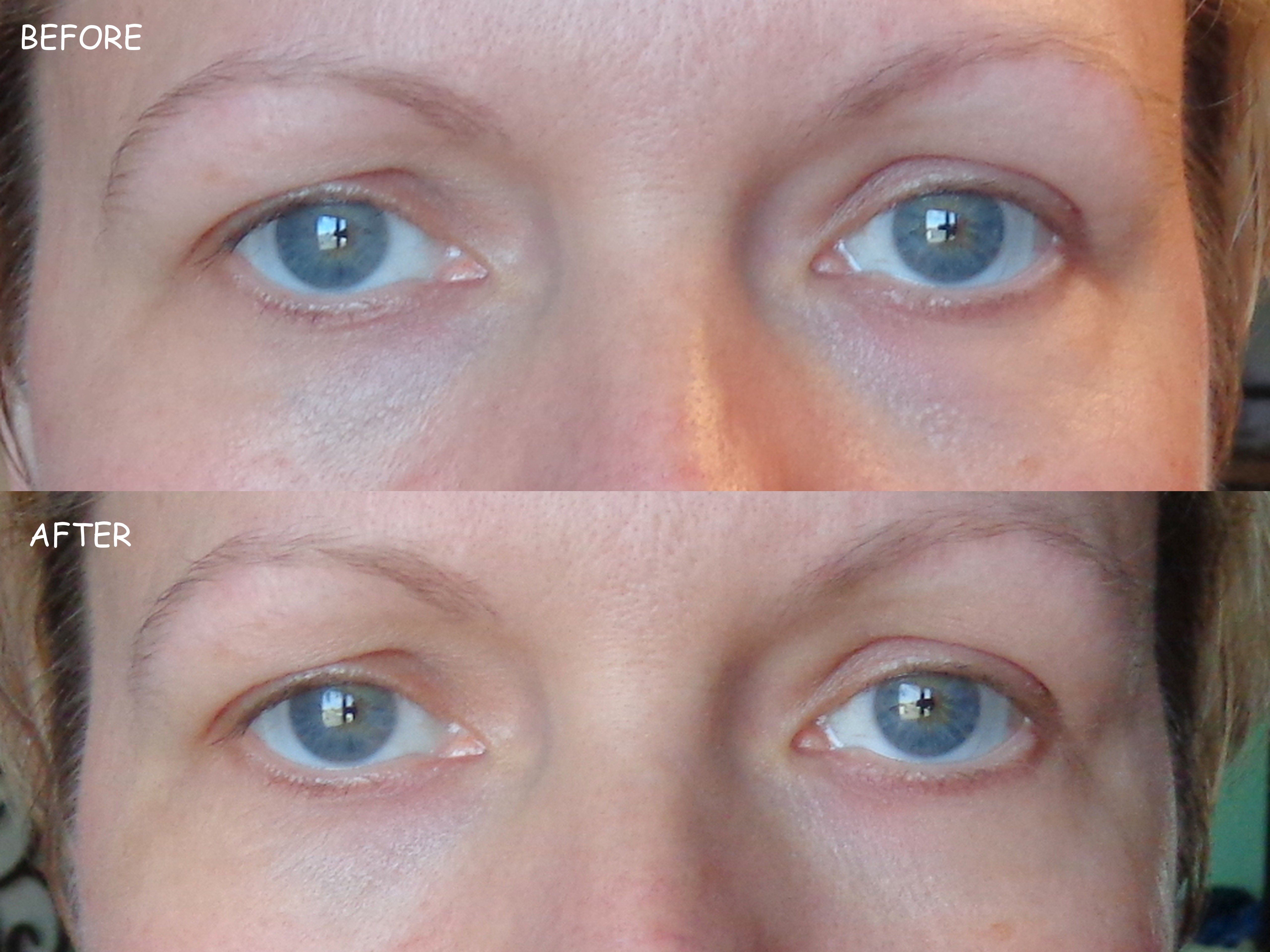 Sudden Change Brings Results for Your Under-Eye Area - My Highest Self