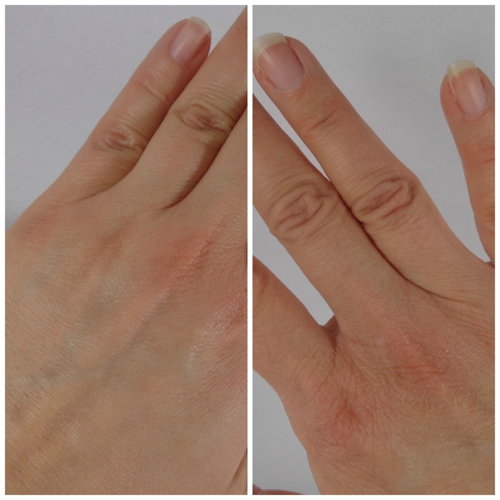 Vaseline Healing Serum Results on Hands